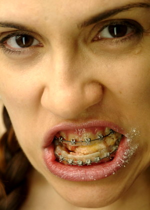 Beautyandbraces Model